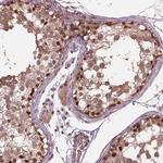 PSMD11 Antibody in Immunohistochemistry (Paraffin) (IHC (P))