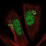 PSMD11 Antibody in Immunocytochemistry (ICC/IF)
