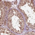 PSMD11 Antibody in Immunohistochemistry (IHC)