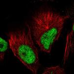 GABPB1 Polyclonal Antibody