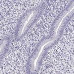 PP11 Antibody in Immunohistochemistry (Paraffin) (IHC (P))