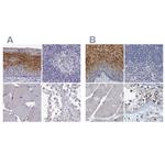 PP11 Antibody in Immunohistochemistry (IHC)