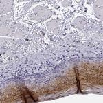 PP11 Antibody in Immunohistochemistry (IHC)