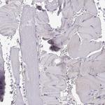 PP11 Antibody in Immunohistochemistry (IHC)