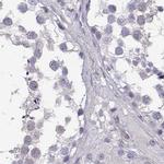 PP11 Antibody in Immunohistochemistry (IHC)