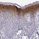 PP11 Antibody in Immunohistochemistry (IHC)