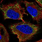 KIAA1161 Polyclonal Antibody