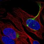 C19orf25 Polyclonal Antibody