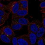 SLC35D3 Polyclonal Antibody