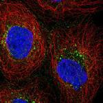 PRPS2 Polyclonal Antibody