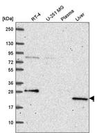 PRPS2 Antibody in Western Blot (WB)