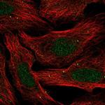 SLC30A3 Polyclonal Antibody