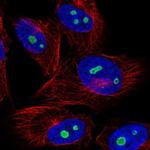 NOC3L Polyclonal Antibody