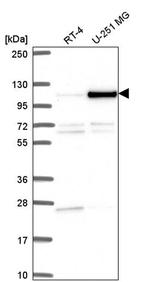 NOC3L Antibody in Western Blot (WB)
