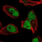 hnRNP UL2 Polyclonal Antibody