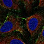 EHD1 Polyclonal Antibody