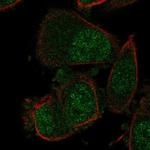 NABP1 Polyclonal Antibody