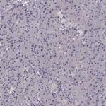 SLC22A18 Antibody in Immunohistochemistry (IHC)