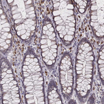 P2X5 Antibody in Immunohistochemistry (Paraffin) (IHC (P))