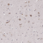 P2X5 Antibody in Immunohistochemistry (Paraffin) (IHC (P))
