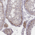 P2X5 Antibody in Immunohistochemistry (Paraffin) (IHC (P))