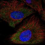 P2X5 Polyclonal Antibody