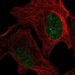 GMPR2 Polyclonal Antibody