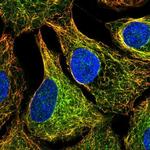 MTUS1 Polyclonal Antibody