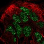 CAMKMT Polyclonal Antibody