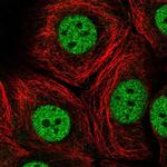 MED13 Polyclonal Antibody