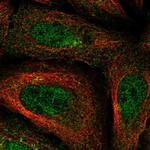 FAM114A1 Polyclonal Antibody