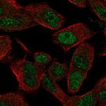 SIX3 Polyclonal Antibody