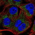 PHYHIP Polyclonal Antibody