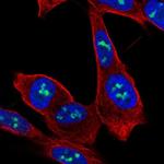 ZNF865 Polyclonal Antibody