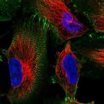 MACF1 Polyclonal Antibody