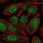 ZNF630 Antibody in Immunocytochemistry (ICC/IF)