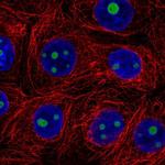 SERTAD3 Polyclonal Antibody