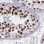 Histone H1T Antibody in Immunohistochemistry (IHC)