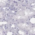 Histone H1T Antibody in Immunohistochemistry (IHC)
