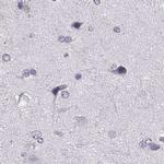 Histone H1T Antibody in Immunohistochemistry (IHC)