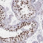 Histone H1T Polyclonal Antibody