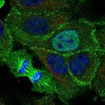 KDF1 Polyclonal Antibody