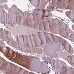 MIB2 Antibody in Immunohistochemistry (IHC)