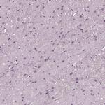 MIB2 Antibody in Immunohistochemistry (IHC)