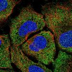 TPTE2 Antibody in Immunocytochemistry (ICC/IF)