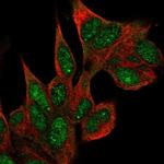 Coilin Antibody in Immunocytochemistry (ICC/IF)