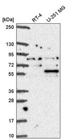 Coilin Antibody in Western Blot (WB)