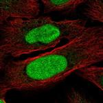 ZNF776 Polyclonal Antibody