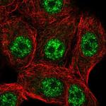 STK19 Polyclonal Antibody