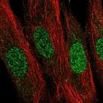 LDB2 Polyclonal Antibody